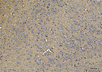 ATP1B1 Rabbit Polyclonal Antibody