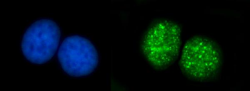 ATRIP Rabbit Polyclonal Antibody