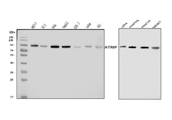 ATRIP Rabbit Polyclonal Antibody
