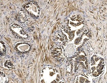 BCKDHA Rabbit Polyclonal Antibody