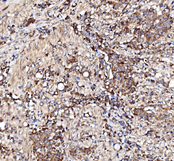 BCKDHA Rabbit Polyclonal Antibody