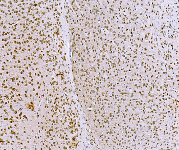BCKDHA Rabbit Polyclonal Antibody