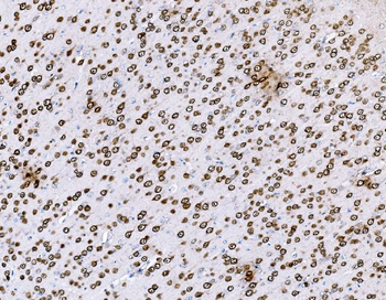 BCKDHA Rabbit Polyclonal Antibody
