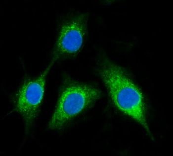 BCKDHA Rabbit Polyclonal Antibody
