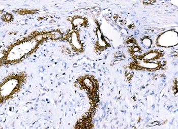 BCKDHA Rabbit Polyclonal Antibody