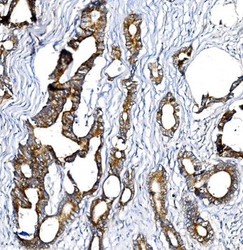 BCKDHA Rabbit Polyclonal Antibody