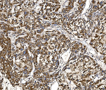 BCKDHA Rabbit Polyclonal Antibody