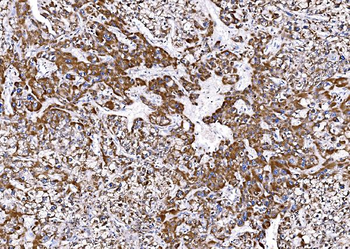 BCKDHA Rabbit Polyclonal Antibody