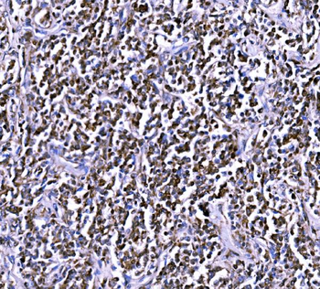BCKDHA Rabbit Polyclonal Antibody