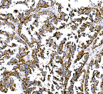 BCKDHA Rabbit Polyclonal Antibody