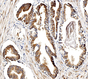 BCKDHA Rabbit Polyclonal Antibody