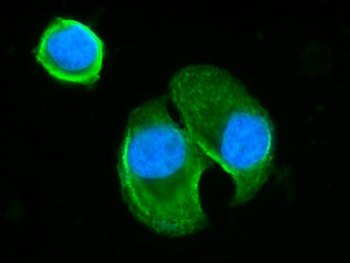 BLNK Rabbit Polyclonal Antibody