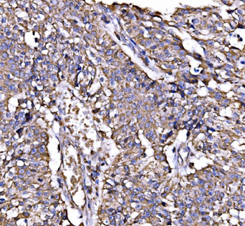Calnexin/CANX Rabbit Polyclonal Antibody