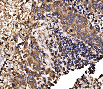 Calnexin/CANX Rabbit Polyclonal Antibody