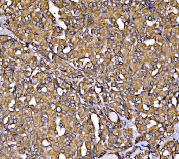 Calnexin/CANX Rabbit Polyclonal Antibody