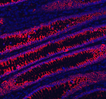 LI Cadherin/CDH17 Rabbit Polyclonal Antibody