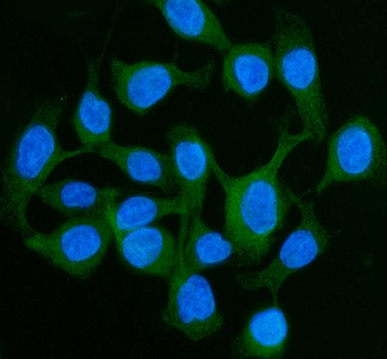 LI Cadherin/CDH17 Rabbit Polyclonal Antibody