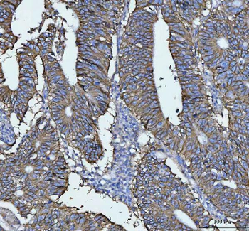 LI Cadherin/CDH17 Rabbit Polyclonal Antibody