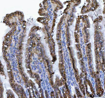 LI Cadherin/CDH17 Rabbit Polyclonal Antibody