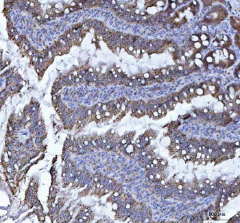LI Cadherin/CDH17 Rabbit Polyclonal Antibody