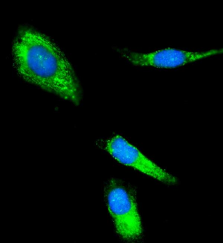 CLPP Rabbit Polyclonal Antibody