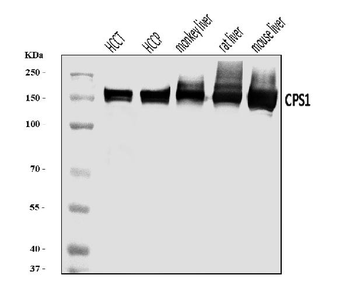 CPS1 Rabbit Polyclonal Antibody