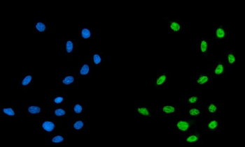 CPSF6 Rabbit Polyclonal Antibody