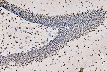 CPSF6 Rabbit Polyclonal Antibody