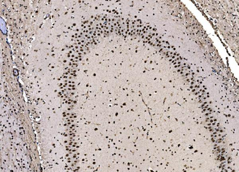 CPSF6 Rabbit Polyclonal Antibody