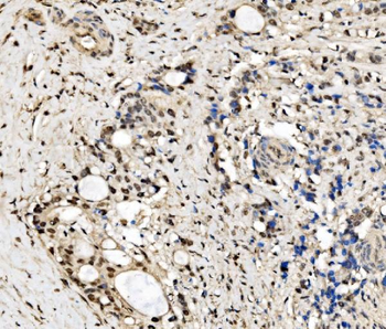 CPSF6 Rabbit Polyclonal Antibody