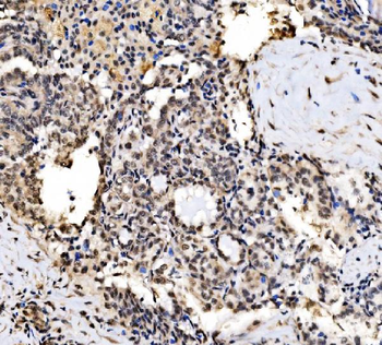 CPSF6 Rabbit Polyclonal Antibody