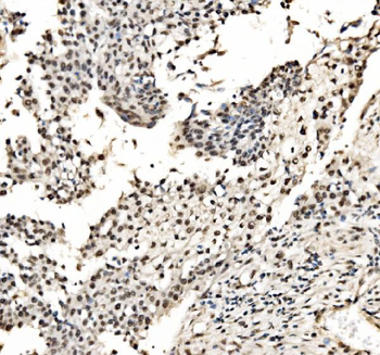 CPSF6 Rabbit Polyclonal Antibody