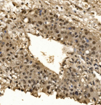 CPSF6 Rabbit Polyclonal Antibody