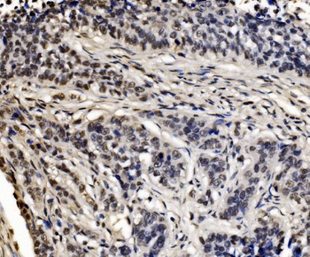 CPSF6 Rabbit Polyclonal Antibody