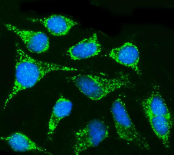 CPT1B Rabbit Polyclonal Antibody
