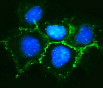 delta 1 Catenin/CAS/CTNND1 Rabbit Polyclonal Antibody