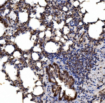 delta 1 Catenin/CAS/CTNND1 Rabbit Polyclonal Antibody