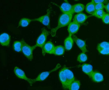 Drebrin/DBN1 Rabbit Polyclonal Antibody