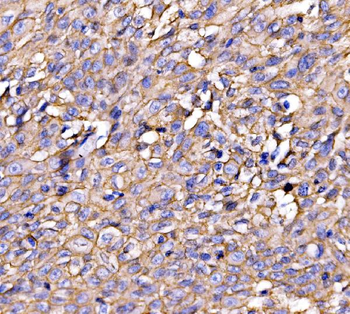 Drebrin/DBN1 Rabbit Polyclonal Antibody