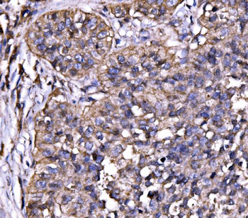 Drebrin/DBN1 Rabbit Polyclonal Antibody