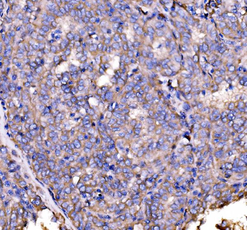 Drebrin/DBN1 Rabbit Polyclonal Antibody