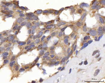 DLST Rabbit Polyclonal Antibody