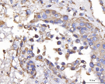 DLST Rabbit Polyclonal Antibody