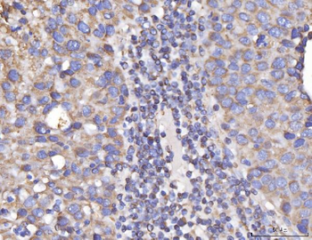 DLST Rabbit Polyclonal Antibody