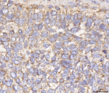 DLST Rabbit Polyclonal Antibody