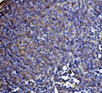 DLST Rabbit Polyclonal Antibody