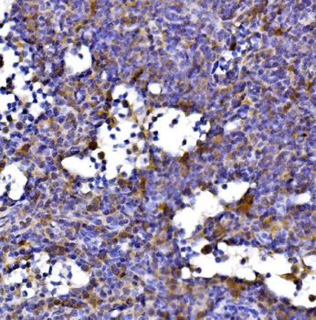 DLST Rabbit Polyclonal Antibody