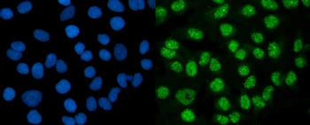 DMAP1 Rabbit Polyclonal Antibody