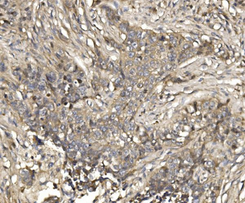 EIF4EBP1 Rabbit Polyclonal Antibody