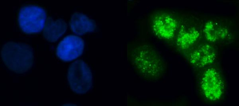 ELL Rabbit Polyclonal Antibody